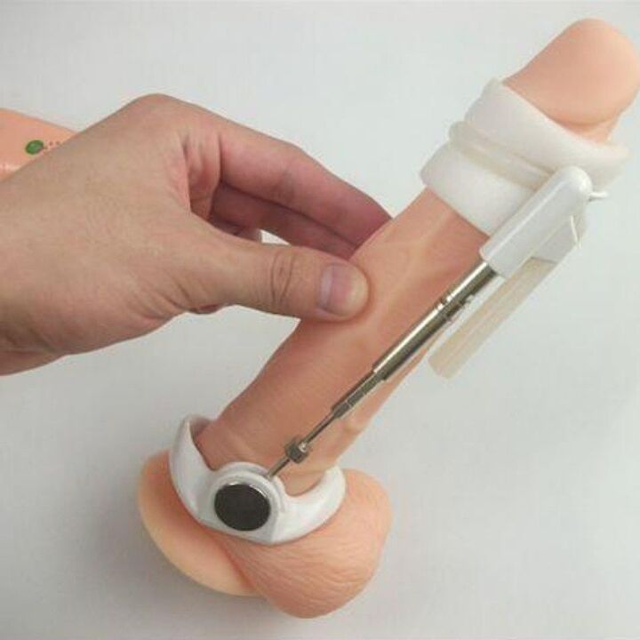 The extender will help increase the size of the penis without creams
